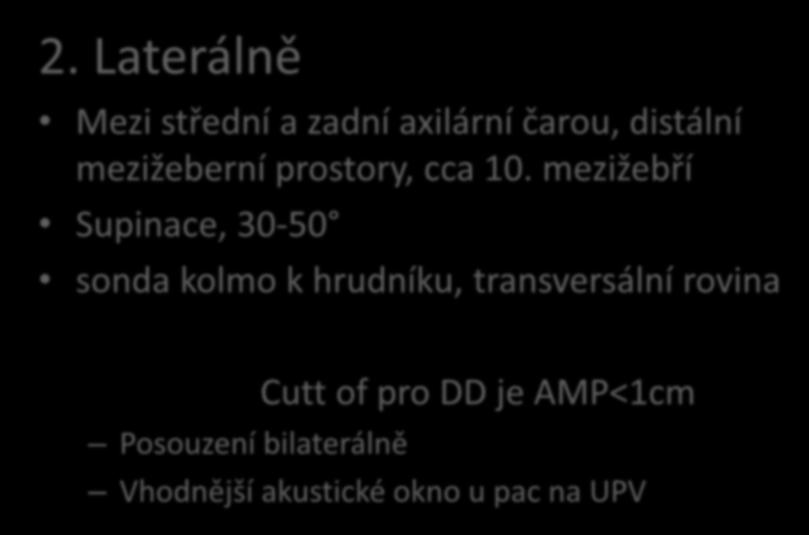 Měření amplitudy - AMP 2.