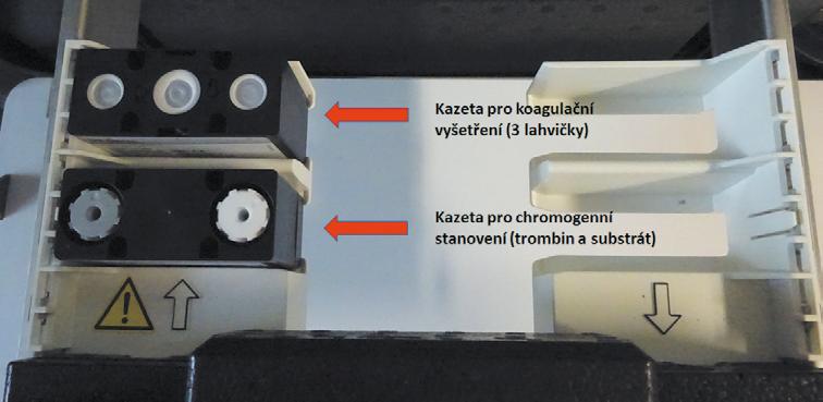 Nový typ koagulačního analyzátoru cobas t 11, který představuje inovativní způsob používání a přípravy reagencií, byl nainstalován a vyzkoušen v centrální hematologické laboratoři v průběhu března