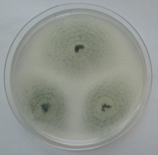 SEZNAM PŘÍLOH Aspergillus