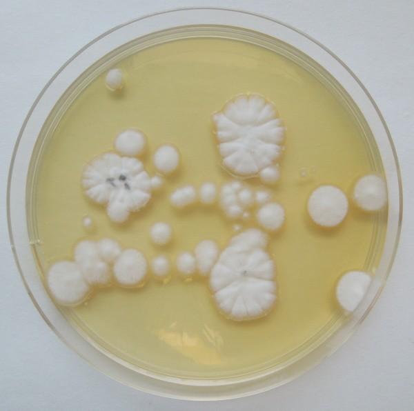 Penicillium crustosum na MHA (Paráková, 2013)