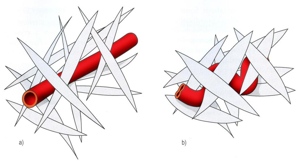 Myometrium