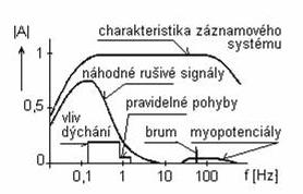 4.1 Rušení v EKG Při měření EKG signálu se v praxi setkáváme s různými typy rušení (obrázek 4.1): 1.