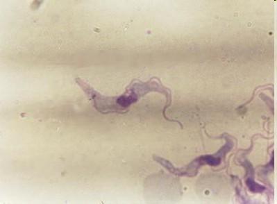 Reduviidae), kontaminací z výkalů při sání rezervoár - drobní savci Leishmania tropica ničivka kožní, suché kožní vředy,