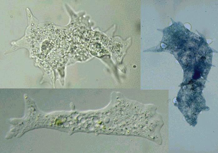cysty Amoeba proteus - měňavka velká 1 mm, prstovité pseudopodie Entamoeba histolytica - měňavka