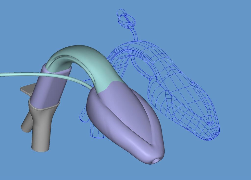 Design insertion success Contour of Airway