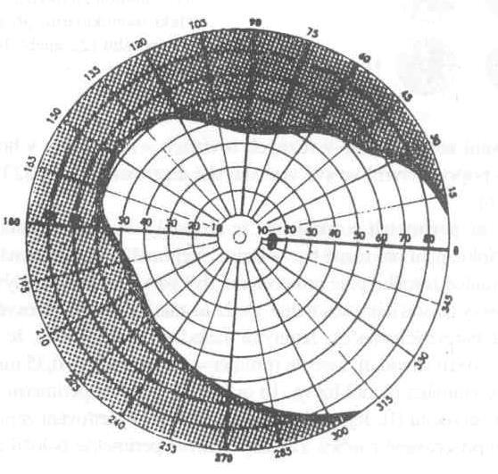 relativní skotom. Při poškození sítnice nebo zrakového nervu je skotom vždy monokulární. Tvar, velikost, lokalizace a stupeň poruchy určují jeho charakter.