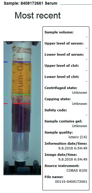 ZKUŠENOSTI Z LABORATOŘÍ Jako hraniční byly určeny hodnoty sérových indexů SIH = 20 μmol/l, SIH = 100 μmol/l, SII = 60 μmol/l a SIL = 35 μmol/l. Minimální počet vzorků na kategorii byl 50.