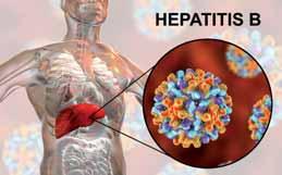 KLINICKÁ HODNOTA DIAGNOSTIKY Vírusová hepatitída B (VHB) je infekčné ochorenie pečene. Prenáša sa krvou a telesnými tekutinami.