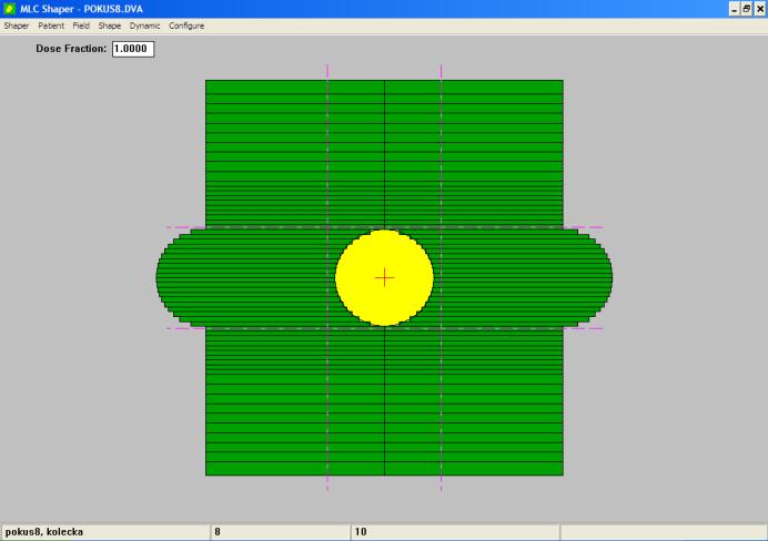 Metody Návrh testovací fluence: V programu MLC Shaper Průměrná velikost gradientu a počet gradientů stejný jako u klinických polí Ověření v klinické praxi: 1 měsíc ve FN Na Bulovce Celkem 15 vzorků: