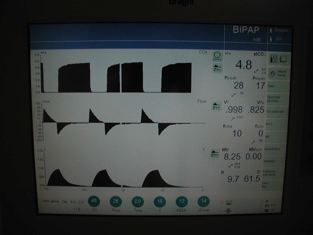 S t r á n k a 9 bezpečnostním prvkem zabraňujícím podání hypoxické směsi v případě anestezie s nízkým příkonem čerstvé směsi (low a minimal flow).