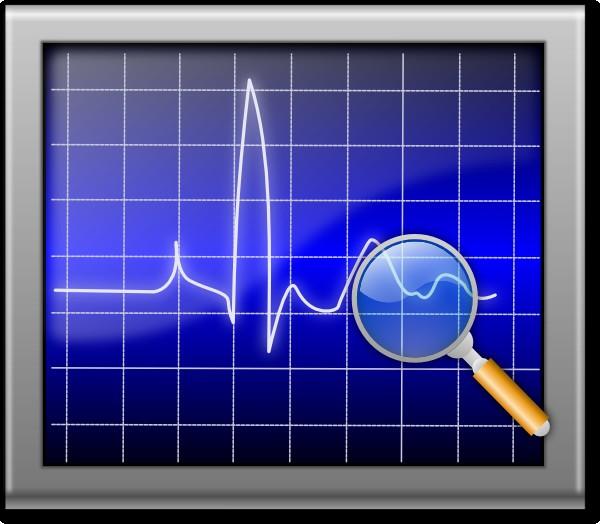 Monitoring Anomálie v síti Podezřelé chování zařízení Podezřelé chování uživatelů Posílání spamu Přihlašování uživatelů ke službám Scan / bruteforce RDP, SSH,