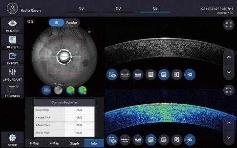 Panoramatická funkce pro široký záběr periferie Lze zachytit více snímků očního pozadí z různých poloh a automaticky je spojit dohromady, aby se optimalizoval