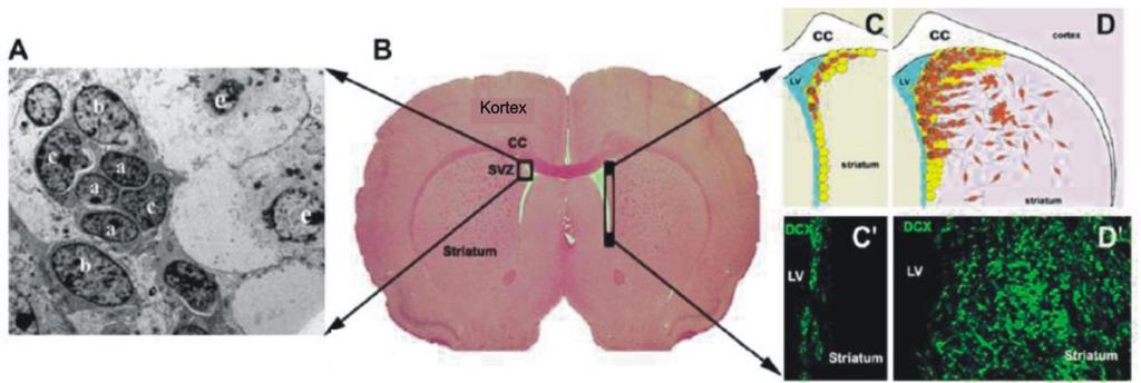 Obr. 8 Změna migrace A-buněk v SVZ po ischemickém poškození (Zhang, Zhang et al. 2008) (A) Zobrazení buněčné struktury SVZ, obsahuje A-, B- a C-buňky. (B) Koronární řez mozkem.