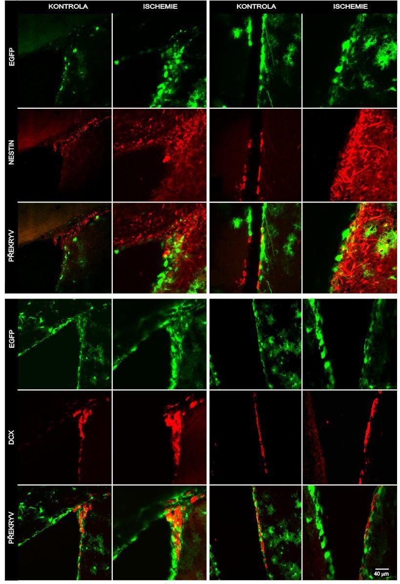 Obr. 16 Zvýšení exprese nestinu a DCX v SVZ tři dny po MCAO Imunohistochemická analýza rohu postranní