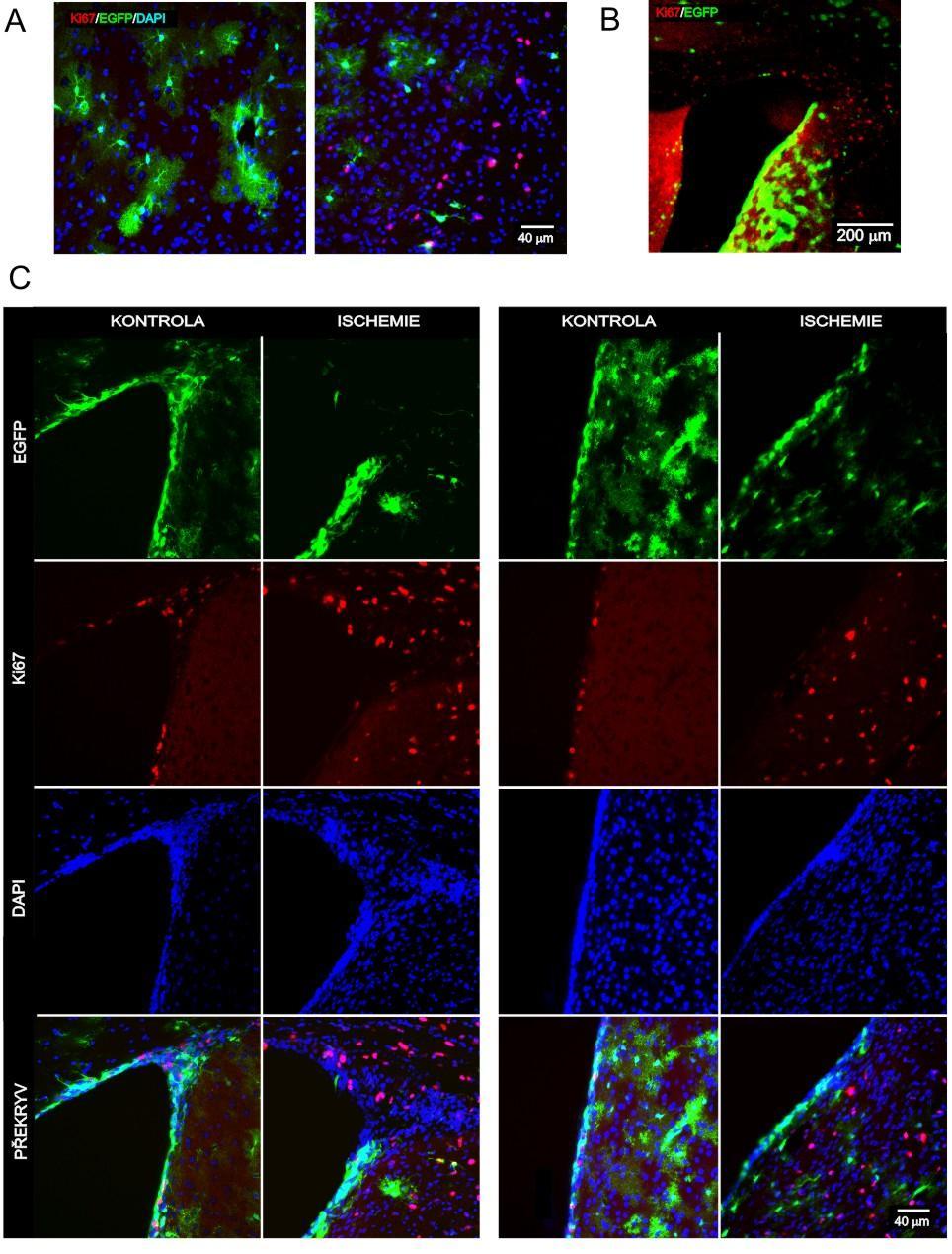 Obr. 22 Zvýšená proliferace v kortexu a v SVZ 3 dny po MCAO (A) Zvýšená proliferace buněk na rozhraní ischemické a nepoškozené oblasti v kortexu po MCAO (vpravo) a kontrola ze stejné oblasti, kde