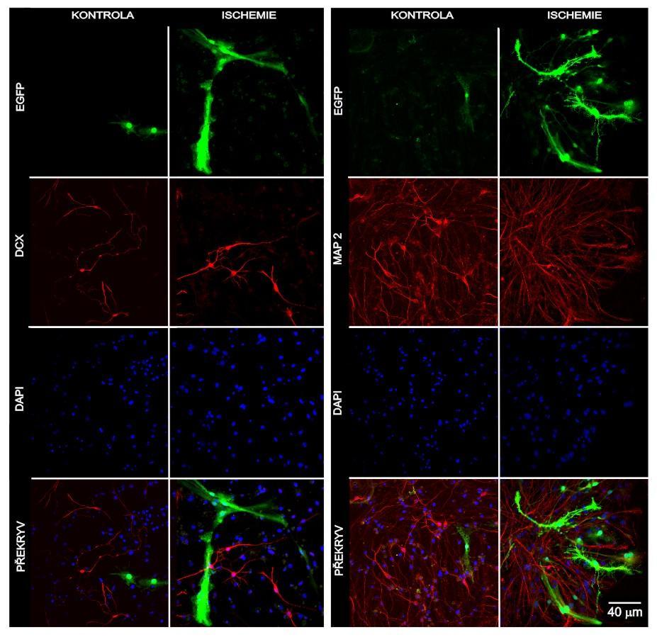 Obr. 27 Srovnatelná diferenciace buněk po MCAO Nově vzniklé neurony pozitivní na DCX (vlevo) a zralejší neurony značené protilátkou proti MAP2