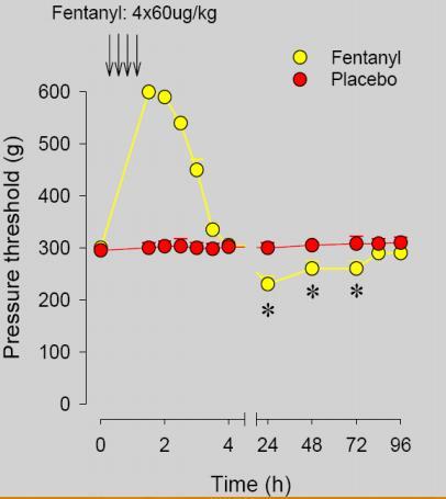 Imunosuprese indukovaná opioidy (Wybran, J Immunol 1979; Sacerdote, Curr Pharm