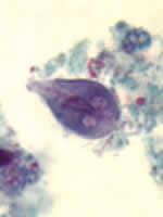 Giardia