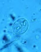 Giardia