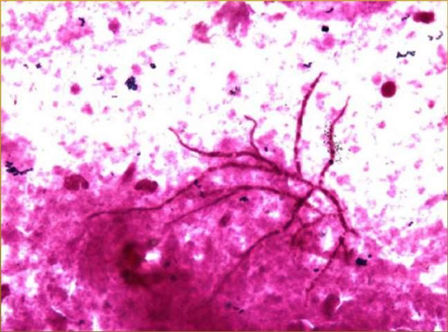 preparát - Candida spp.