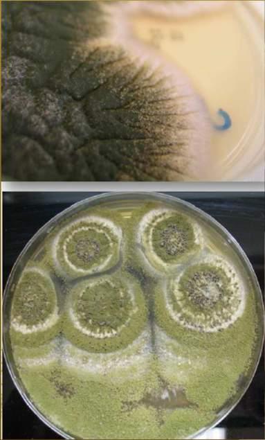 ureázový agar, ovesný agar, Čapkův agar