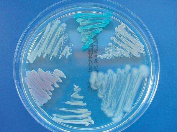 agar... diagnostická kultivace