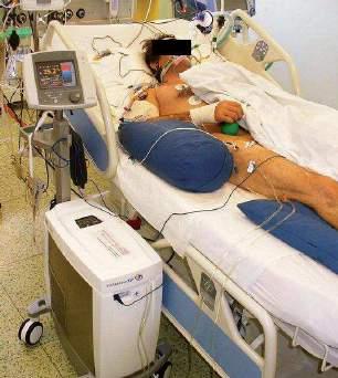 (hlavně s neutropenií nebo po transplantaci krvetvorných bb.