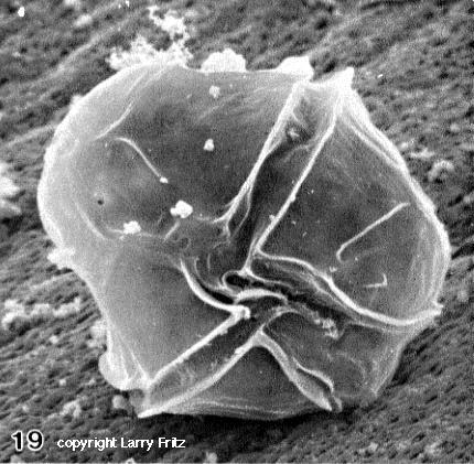 domoová kyselina Pseudonitzschia diatoms -