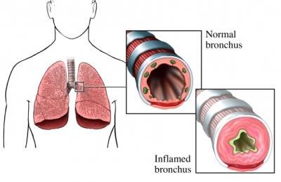 Absorpce v GIT jen v prostředí žaludku - Kontaktní dermatitida