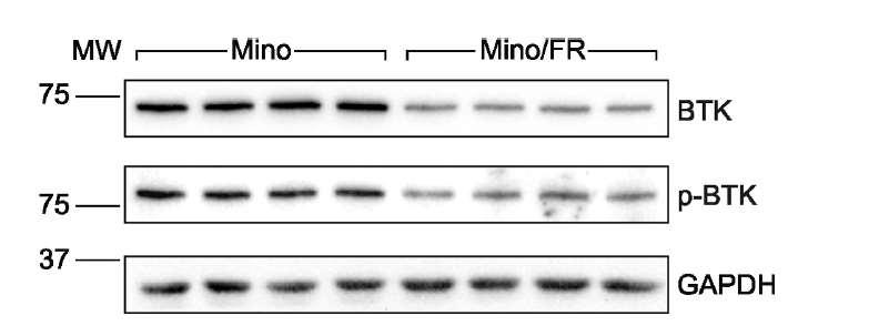 Decreased bruton tyrosine kinase (BTK)