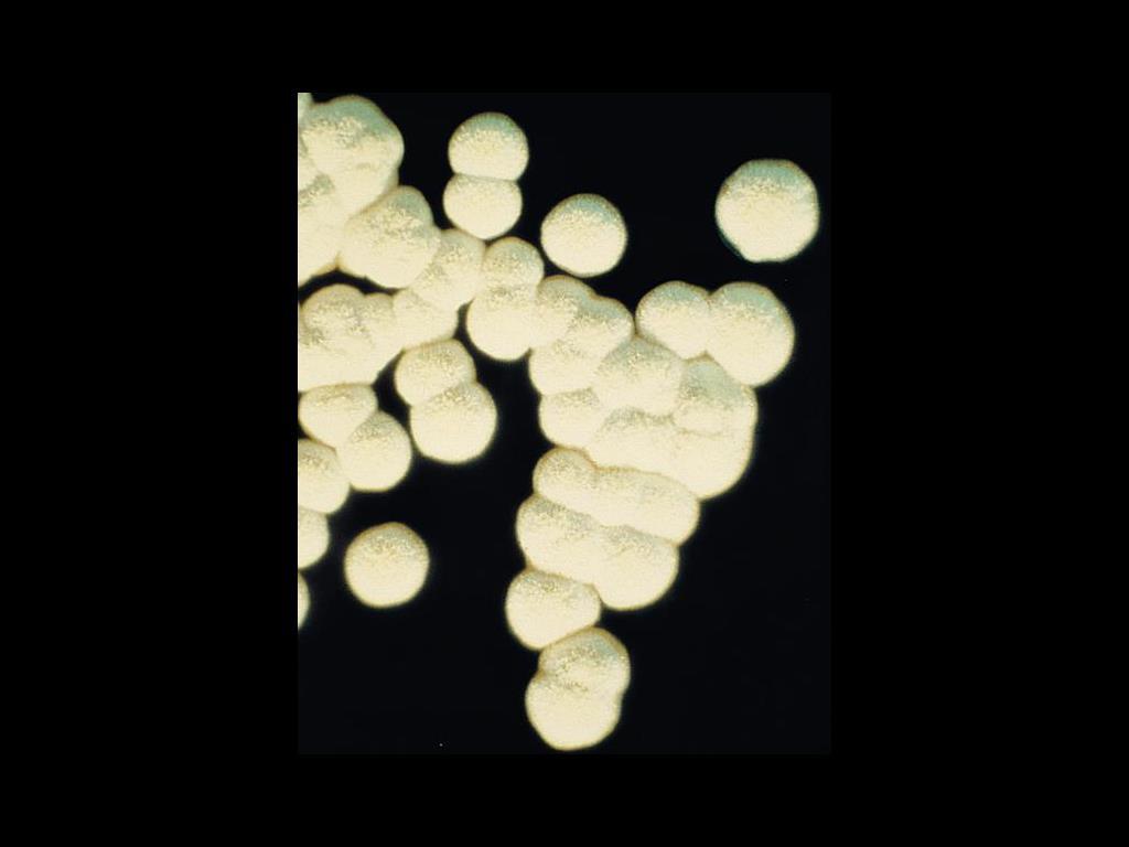 Colonies of Nocardia asteroides