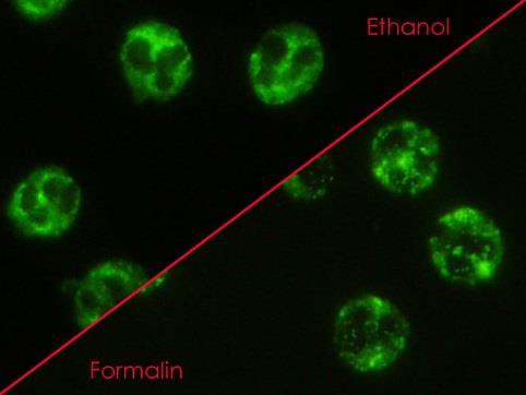 ANCA (= Anti-Neutrophil Cytoplasm Antibodies) obecný název pro všechny autoprotilátky namířené proti cytoplazmatickým antigenům neutrofilů cílové antigeny ANCA