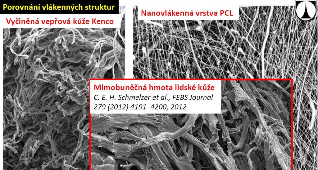 Kožní infekce a LPPOs Nanotextilie Podobné struktuře MB hmoty Biodegradabilní Krytí ran průnik vzduchu