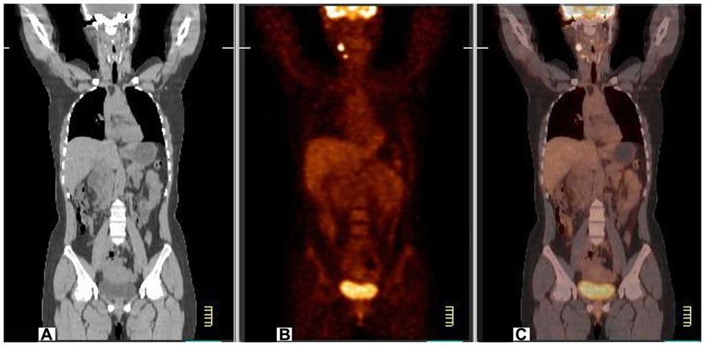 PET/CT