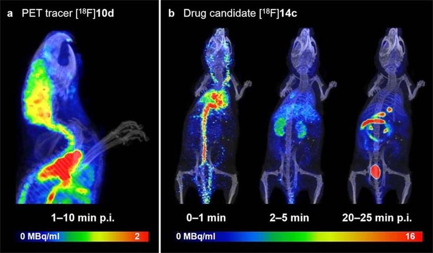 PET/CT