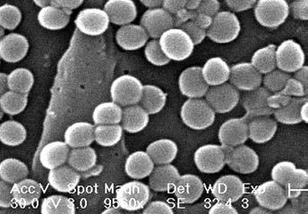 2-1: Tyãinkovitá bakterie 2 3 0,8 µm. Elektronoptick snímek Escherichia coli, která mûïe b t i del í pfies 10 µm.