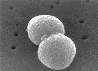 Elektronoptick snímek bakterie Staphylococcus aureus.