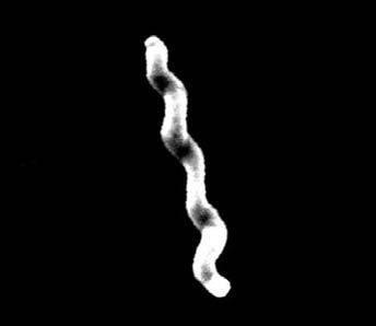 12 Ze života bakterií 2-5: tíhlé tûlo bakterie, nûkolikrát v jedné rovinû prohnuté, o délce 3 µm, silné kolem 0,7 µm. Elekronoptick snímek kampylobakteru.