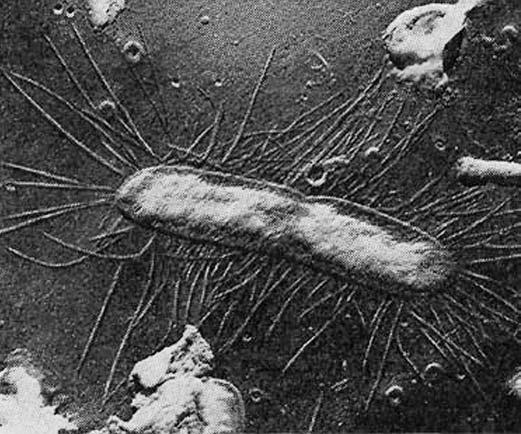 14 Ze života bakterií 2-9: Fimbrie, krátké pfiívûsky na povrchu buàky Escherichia coli, slouïící kromû jiného k pfiilnutí k pevnému povrchu, napfiíklad na buàku sliznice.