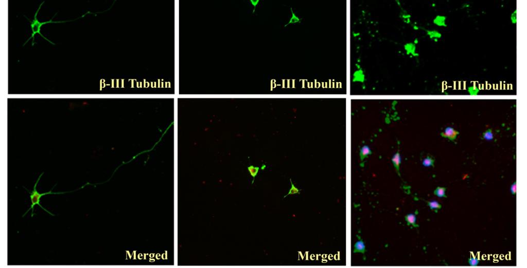 changes in 3,5µM juglone for 2,5 hours and