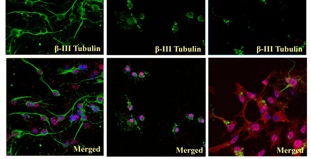 3: Cyclin A expression in untreated cells, at 4µM juglone for 3 hours of incubation and