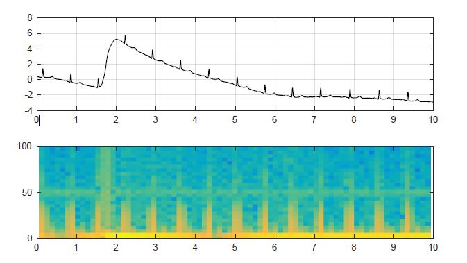 12. Mějme následující signál a jeho časově-frekvenční reprezentaci (periodogram). Popište obrázky, uveďte popisky k osám x, y a vysvětlete. 13.