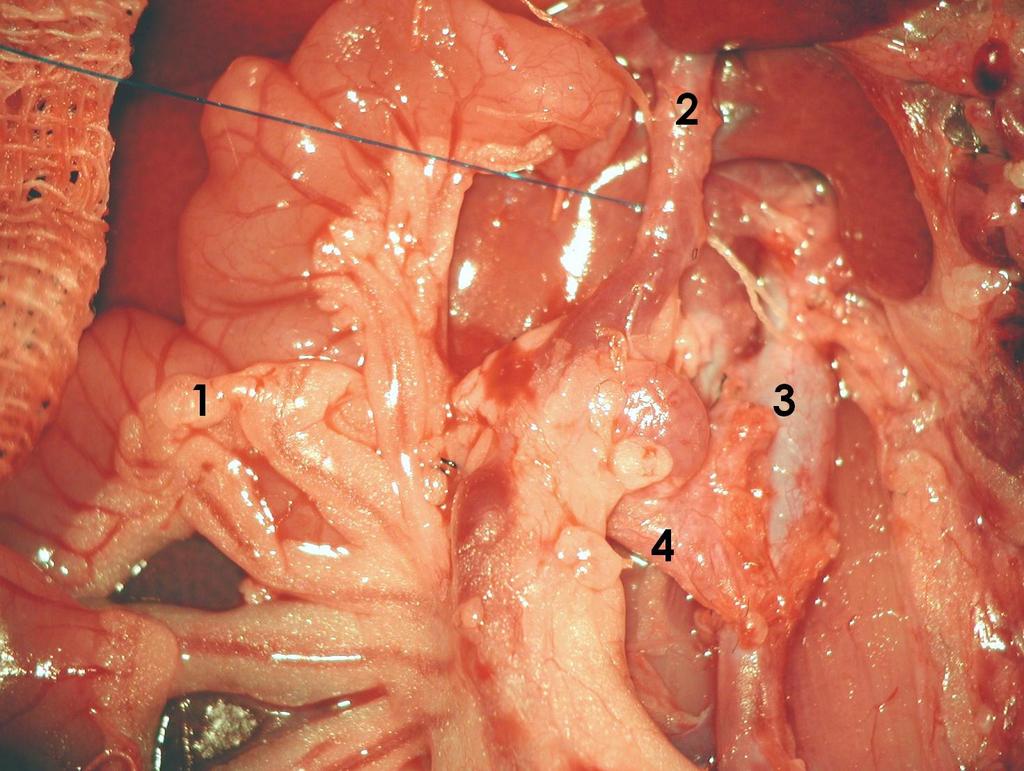 Obr. 9- Pohled na štěp před perfuzí ochranným roztokem (1 střevní štěp, 2 vena portae, 3 aorta, 4 arteria mesenterica cranialis) Podvážeme silonovou ligatorou břišní aortu nad bifurkací, další