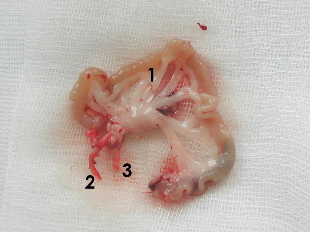 Obr. 10 - Celkový pohled na střevní štěp po promytí ochranným roztokem (1 střevní štěp, 2- aorta s odstupem amc, 3 vena portae) 3.1.6 Transplantace štěpu tenkého střeva se systémovou žilní drenáží K celkové anestesii jsme použili stejnou kombinaci anestestik jako při odběru.