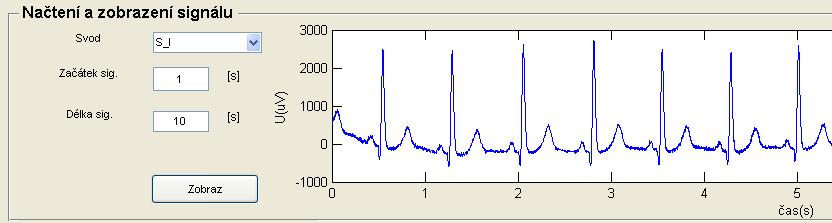 K realizací programů byl použit nástroj GUI v prostředí MATLAB, verze 7.6.0 (R2008). Okno aplikace je optimalizováno na rozlišení monitoru 1440x900 pixelů.