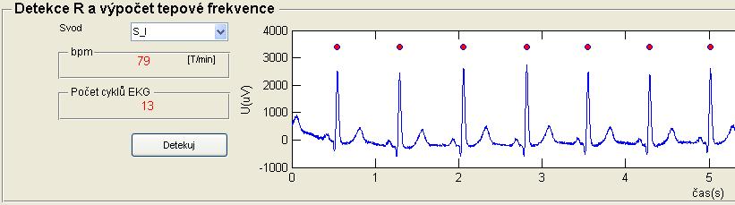 polohám R, muže uživatel pomocí rolovacího menu zvolit jiný svod pro detekci R a provést znovu detekci stisknutím tlačítka Detekuj. Obrázek 9.