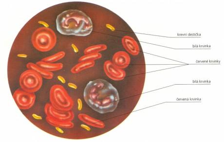 Krev Normální objem- normovolemie 4,5-6 litrů Snížení objemu : dehydratace (krvinek stejně, ubylo vody) ztráta - krvácení, rychlost, riziko 1,5litru rychle, lze kompenzovat až 2,5litru pomalé