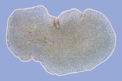 Placozoa - vločkovci tělo je ploché (vločkovité), asymetrické a proměnlivého tvaru nejjednodušší neparazitičtí živočichové, chybí svalové