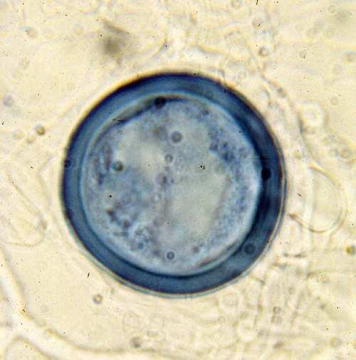 rozmnožování: zygospóry - pseudofialidy na sporokladiích -hyfy