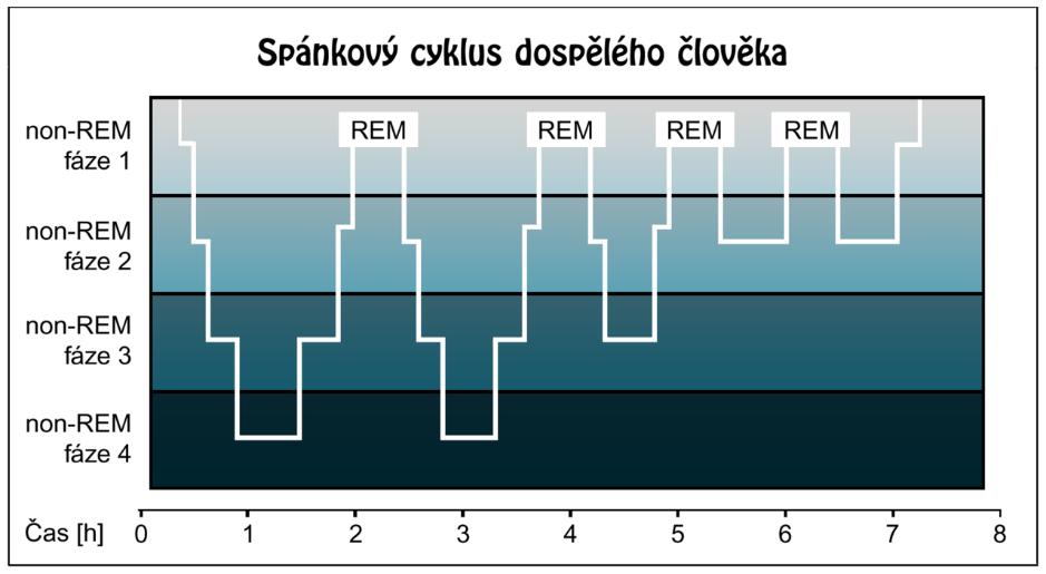 EEG nálezy během spánku NREM 3 stádia, zpočátku 2-7 Hz, charakteristická spánková